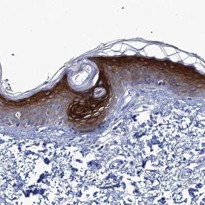 Immunohistochemistry-Paraffin: SCEL Antibody [NBP1-82137]