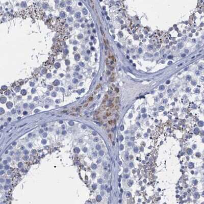 Immunohistochemistry-Paraffin: SCEL Antibody [NBP1-82137]