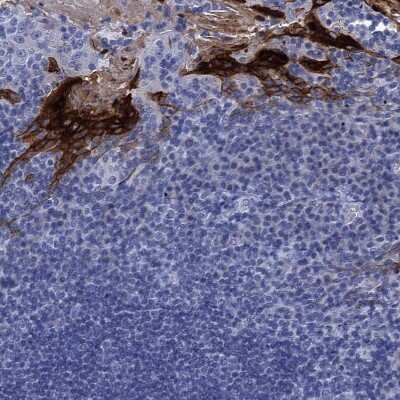 Immunohistochemistry-Paraffin: SCEL Antibody [NBP1-82137]