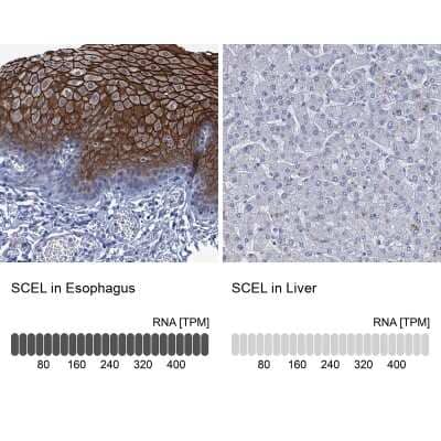 Immunohistochemistry-Paraffin: SCEL Antibody [NBP1-82137]