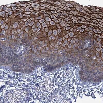 Immunohistochemistry-Paraffin: SCEL Antibody [NBP1-82138]