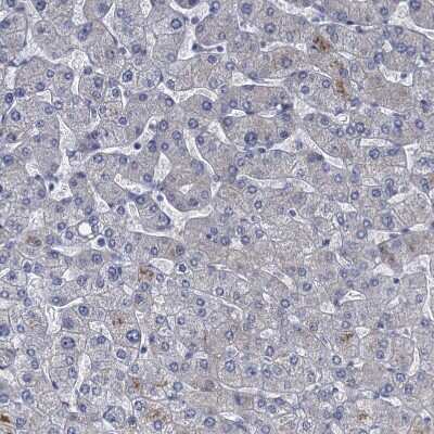 Immunohistochemistry-Paraffin: SCEL Antibody [NBP1-82138]