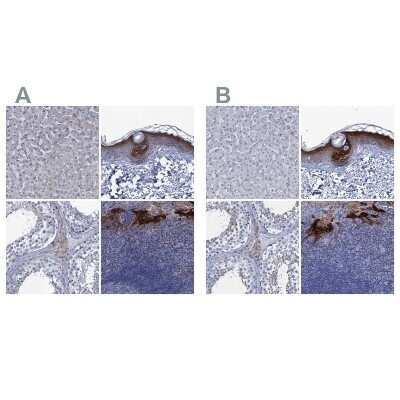 Immunohistochemistry-Paraffin: SCEL Antibody [NBP1-82138]