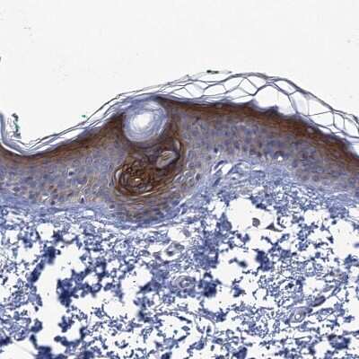 Immunohistochemistry-Paraffin: SCEL Antibody [NBP1-82138]