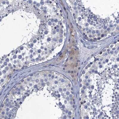 Immunohistochemistry-Paraffin: SCEL Antibody [NBP1-82138]