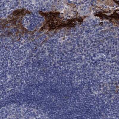 Immunohistochemistry-Paraffin: SCEL Antibody [NBP1-82138]