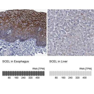 Immunohistochemistry-Paraffin: SCEL Antibody [NBP1-82138]