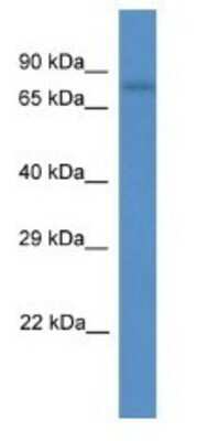 Western Blot: SCEL Antibody [NBP1-79417]