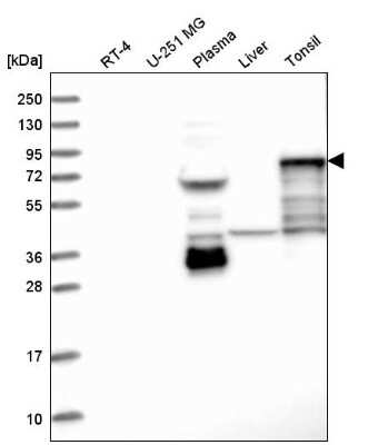 Western Blot: SCEL Antibody [NBP1-82137]
