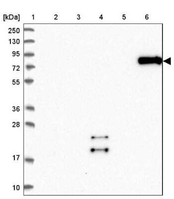 Western Blot: SCEL Antibody [NBP1-82138]