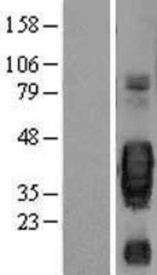 Western Blot: SCF/c-kit Ligand Overexpression Lysate [NBL1-12306]