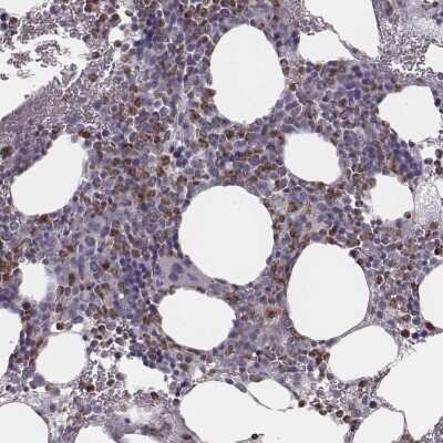 Immunohistochemistry-Paraffin: SCF/c-kit Ligand Antibody [NBP2-57463]