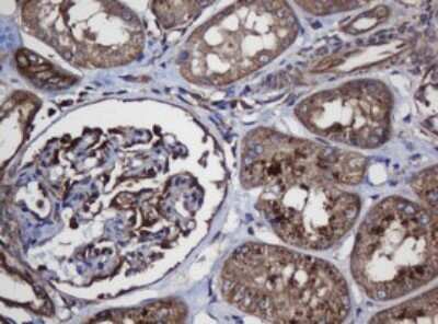Immunohistochemistry: SCFD1 Antibody (OTI4D2) [NBP2-45707]