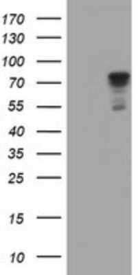 Western Blot: SCFD1 Antibody (OTI4D2) [NBP2-45707]