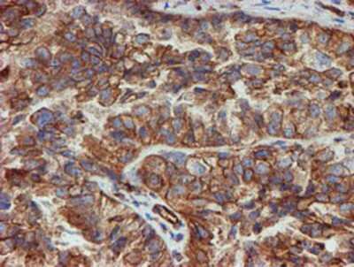 Immunohistochemistry-Paraffin: SCFD1 Antibody (OTI5G4) [NBP2-02031]