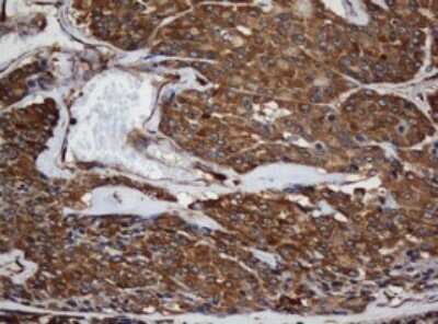 Immunohistochemistry: SCFD1 Antibody (OTI4D2) - Azide and BSA Free [NBP2-74003]