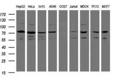 Western Blot: SCFD1 Antibody (OTI4D2)Azide and BSA Free [NBP2-74003]