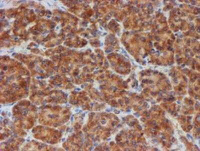 Immunohistochemistry: SCFD1 Antibody (OTI5G4) - Azide and BSA Free [NBP2-74004]