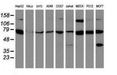 Western Blot: SCFD1 Antibody (OTI5G4)Azide and BSA Free [NBP2-74004]