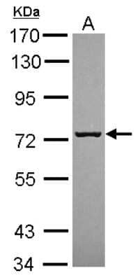 Western Blot: SCFD1 Antibody [NBP2-20268]