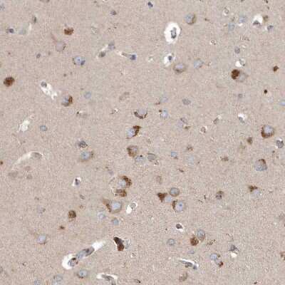 Immunohistochemistry-Paraffin: SCFD2 Antibody [NBP2-38310]