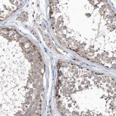 Immunohistochemistry-Paraffin: SCFD2 Antibody [NBP2-38310]