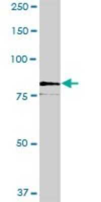 Western Blot: SCFD2 Antibody [H00152579-B01P]