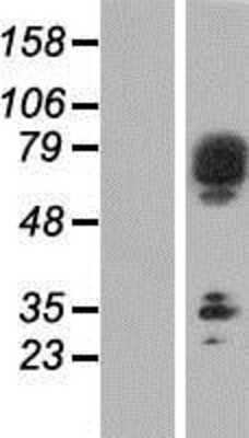 Western Blot: SCFD2 Overexpression Lysate [NBP2-05342]