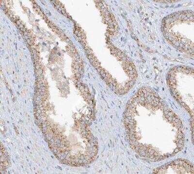 Immunohistochemistry-Paraffin: SCGB1D2 Antibody [NBP1-81304]