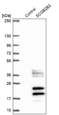 Western Blot: SCGBL Antibody [NBP1-92367]