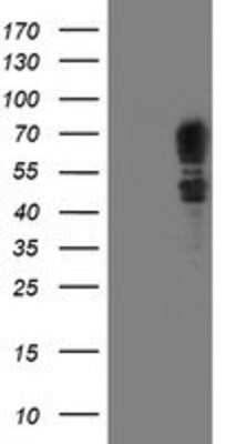 Western Blot: SCHIP1 Antibody (OTI1C8) [NBP2-01872]