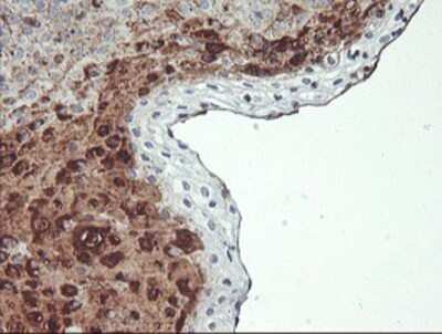Immunohistochemistry: SCHIP1 Antibody (OTI1C8) - Azide and BSA Free [NBP2-74008]