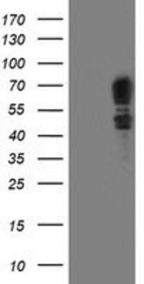 Western Blot: SCHIP1 Antibody (OTI1C8)Azide and BSA Free [NBP2-74008]