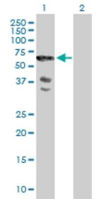 Western Blot: SCHIP1 Antibody [H00029970-B01P]