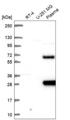 Western Blot: SCHIP1 Antibody [NBP2-68891]