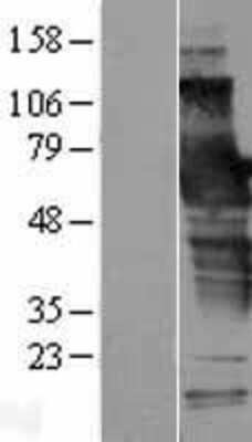 Western Blot: SCHIP1 Overexpression Lysate [NBL1-15736]