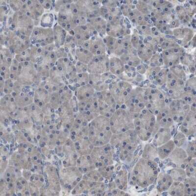 Immunohistochemistry-Paraffin: SCIMP Antibody [NBP2-48502]