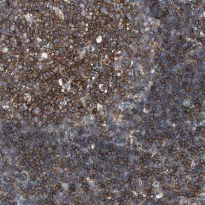 Immunohistochemistry-Paraffin: SCIMP Antibody [NBP2-48502]