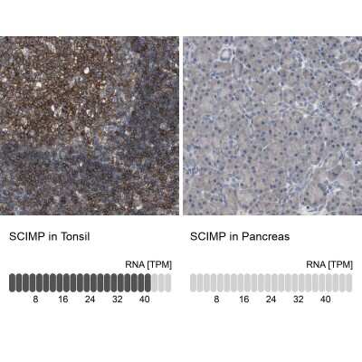 Immunohistochemistry-Paraffin: SCIMP Antibody [NBP2-48502]