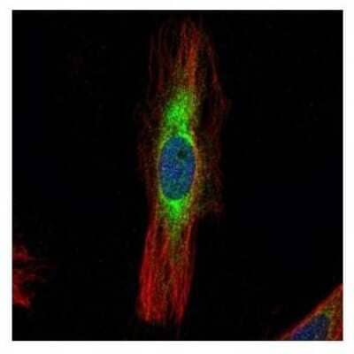 Immunocytochemistry/ Immunofluorescence: SCIN Antibody [NBP1-31721]