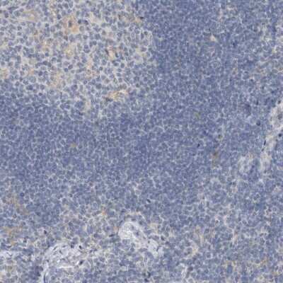 Immunohistochemistry-Paraffin: SCIN Antibody [NBP1-89229]