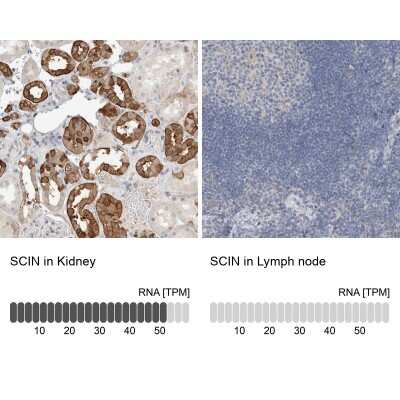 Immunohistochemistry-Paraffin: SCIN Antibody [NBP1-89229]