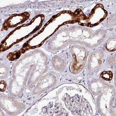 Immunohistochemistry-Paraffin: SCIN Antibody [NBP1-89230]