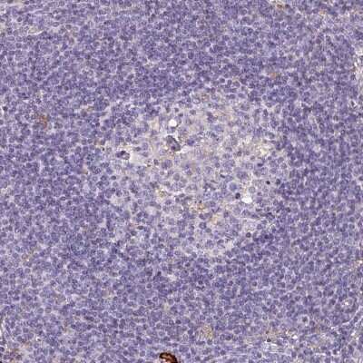Immunohistochemistry-Paraffin: SCIN Antibody [NBP1-89230]