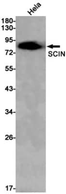 Western Blot: SCIN Antibody (S07-6G2) [NBP3-19768]