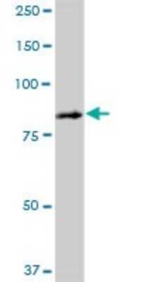 Western Blot: SCIN Antibody [H00085477-B01P]
