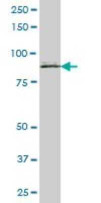 Western Blot: SCIN Antibody [H00085477-B01P]