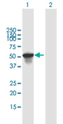 Western Blot: SCIN Antibody [H00085477-B01P]