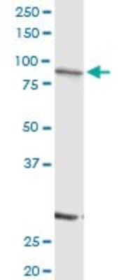 Western Blot: SCIN Antibody [H00085477-D01P]