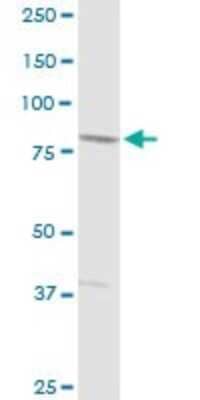 Western Blot: SCIN Antibody [H00085477-D01P]